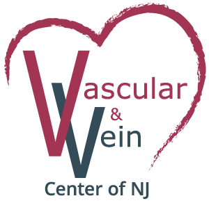 Vascular Vein Center Of New Jersey